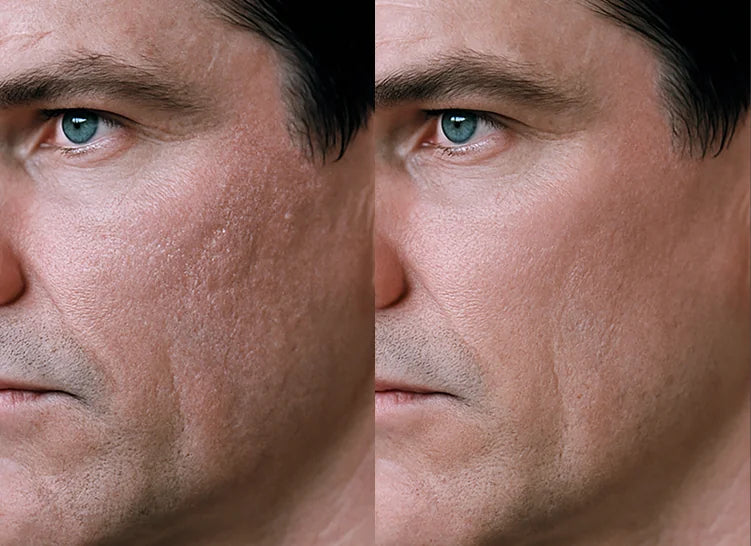 Customer before and after result 3