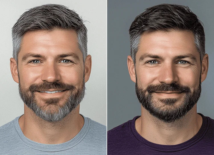 Anti-Gray Serum result