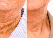 Particle Neck Cream result
