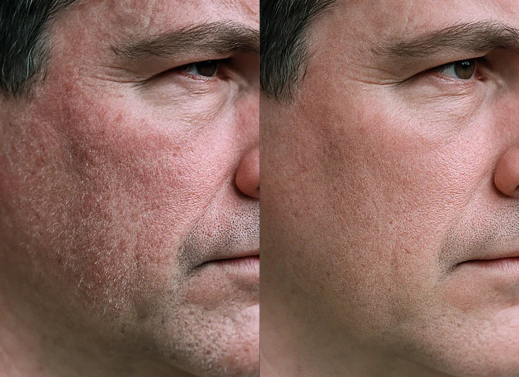 Customer before and after result 1
