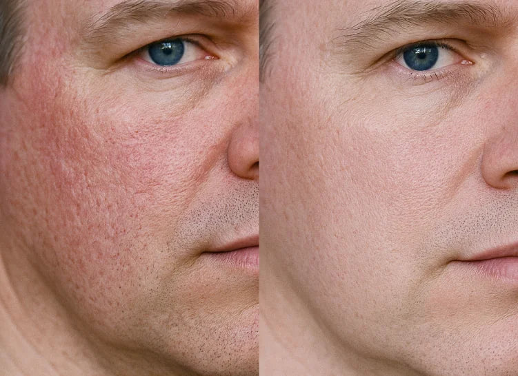 Customer before and after result 4