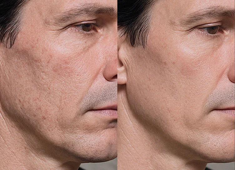 Customer before and after result 5